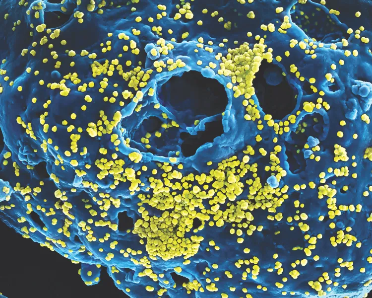 Scanning electron microscope image of MERS