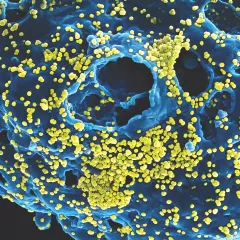 Scanning electron microscope image of MERS